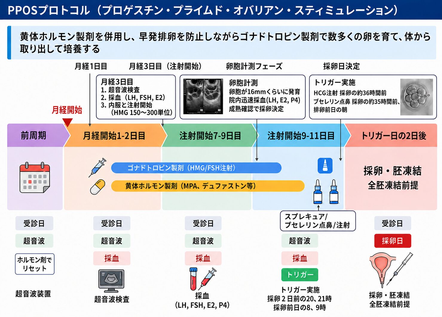 体外受精（IVF）の流れ
